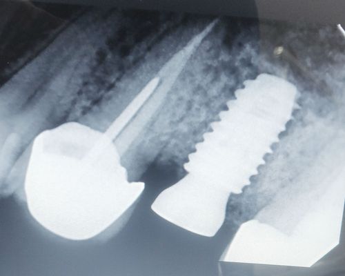 Ivory Dental Clinic & Implant Center  Kharadi Pune
