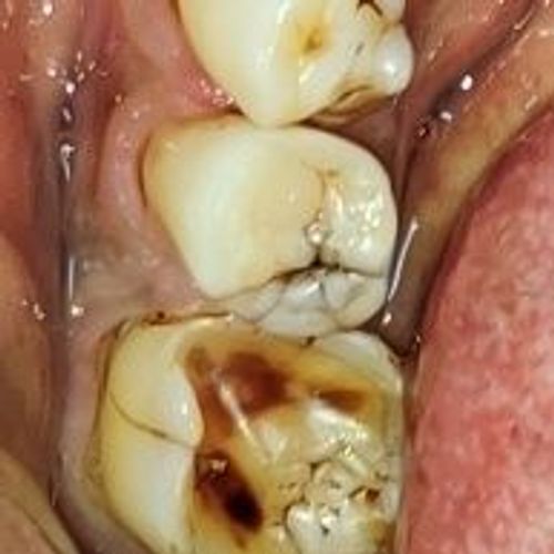 Surgeries & Treatments