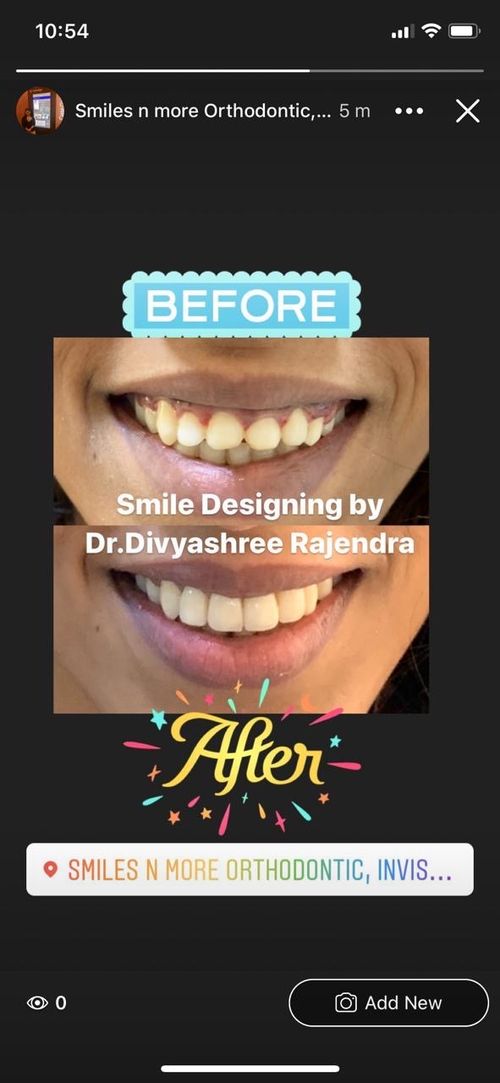 Surgeries & Treatments