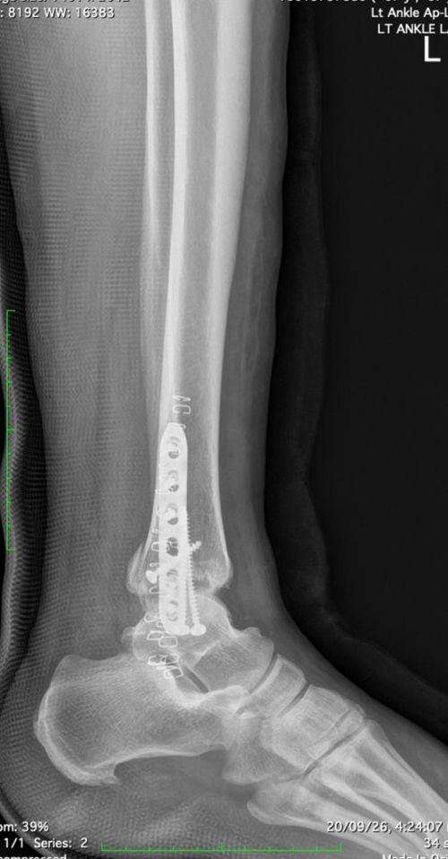 Surgeries & Treatments