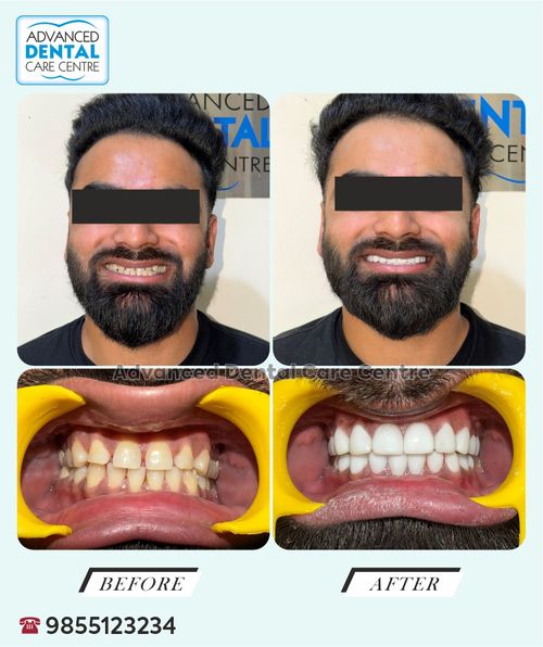 Surgeries & Treatments