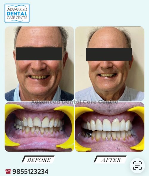 Surgeries & Treatments