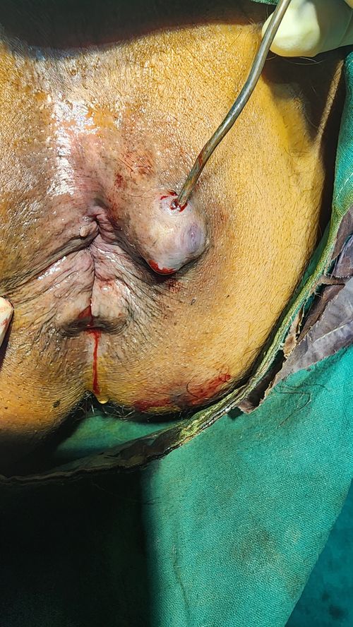 Surgeries & Treatments