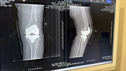 Surgeries & Treatments
