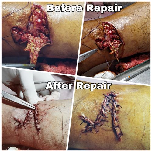 Surgeries & Treatments