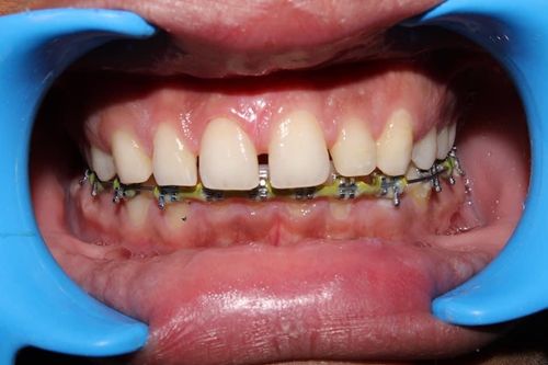 Surgeries & Treatments