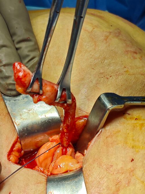 Surgeries & Treatments