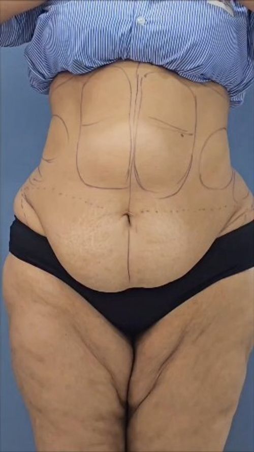 Surgeries & Treatments