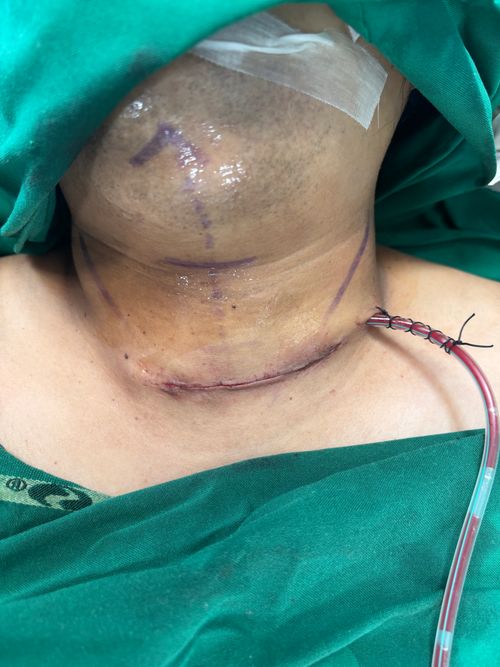 Surgeries & Treatments