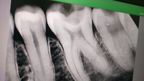 Surgeries & Treatments