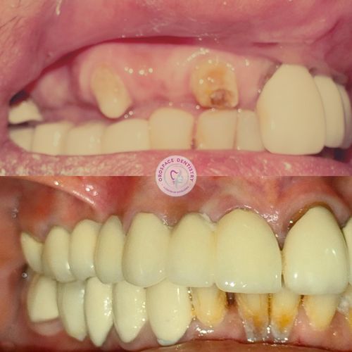 Surgeries & Treatments