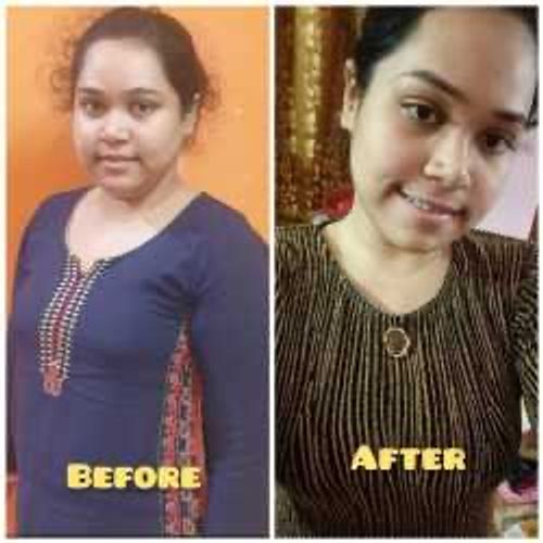 Surgeries & Treatments