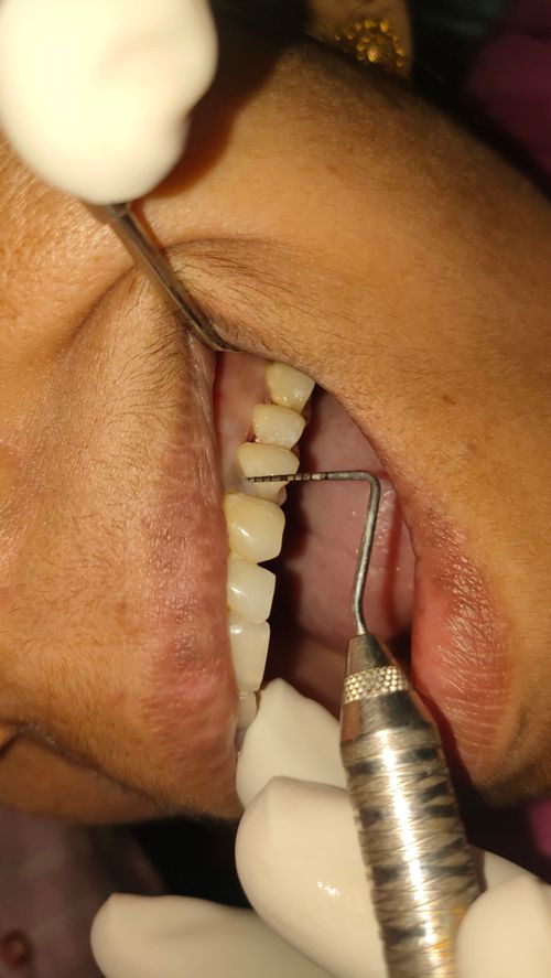 Surgeries & Treatments