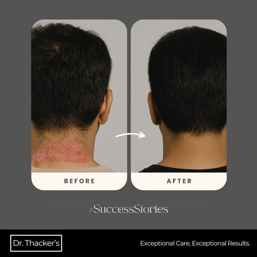 Surgeries & Treatments