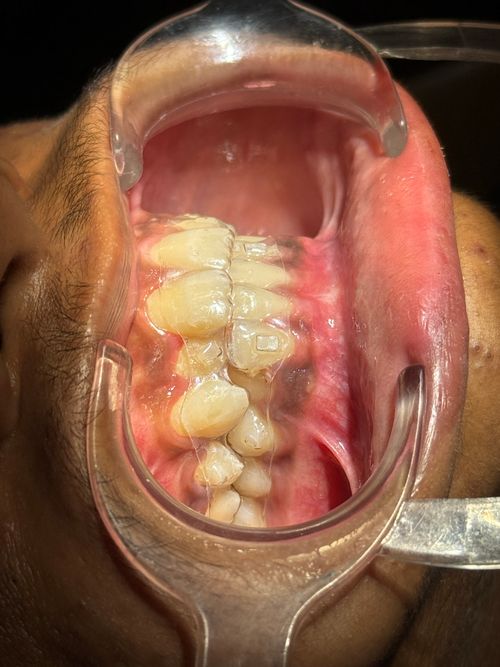 Surgeries & Treatments