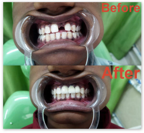 Surgeries & Treatments