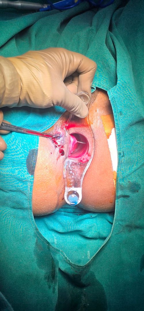 Surgeries & Treatments