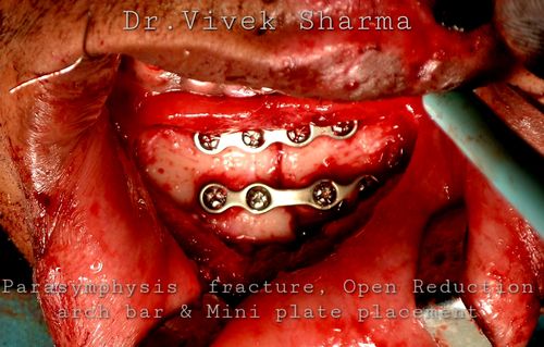 Surgeries & Treatments