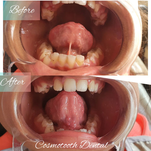 Surgeries & Treatments
