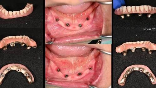 Surgeries & Treatments