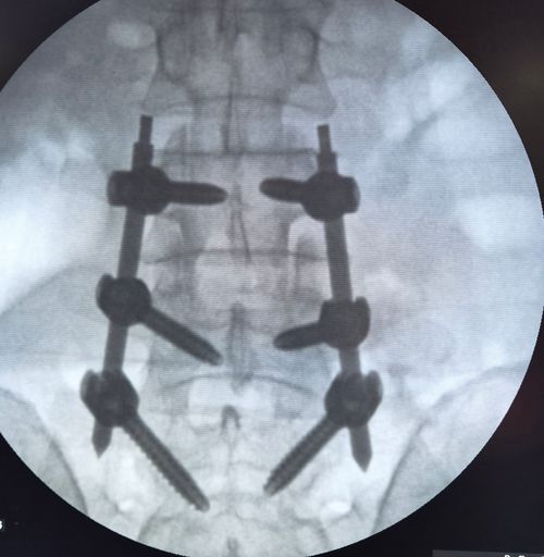 Surgeries & Treatments