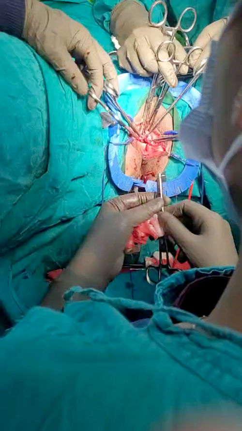 Surgeries & Treatments