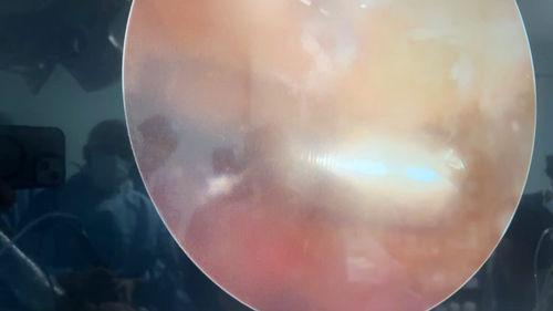 Surgeries & Treatments