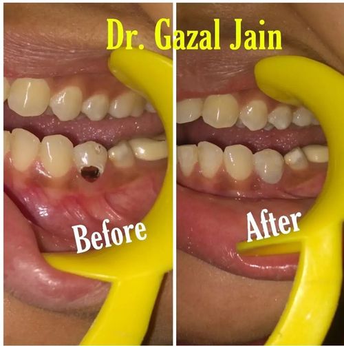 Surgeries & Treatments