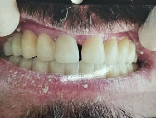 Surgeries & Treatments