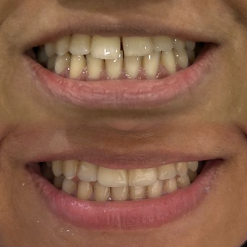 Surgeries & Treatments