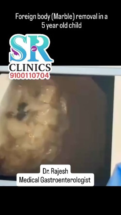 Surgeries & Treatments