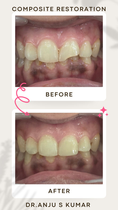 Surgeries & Treatments