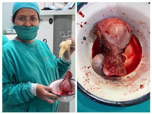 Surgeries & Treatments