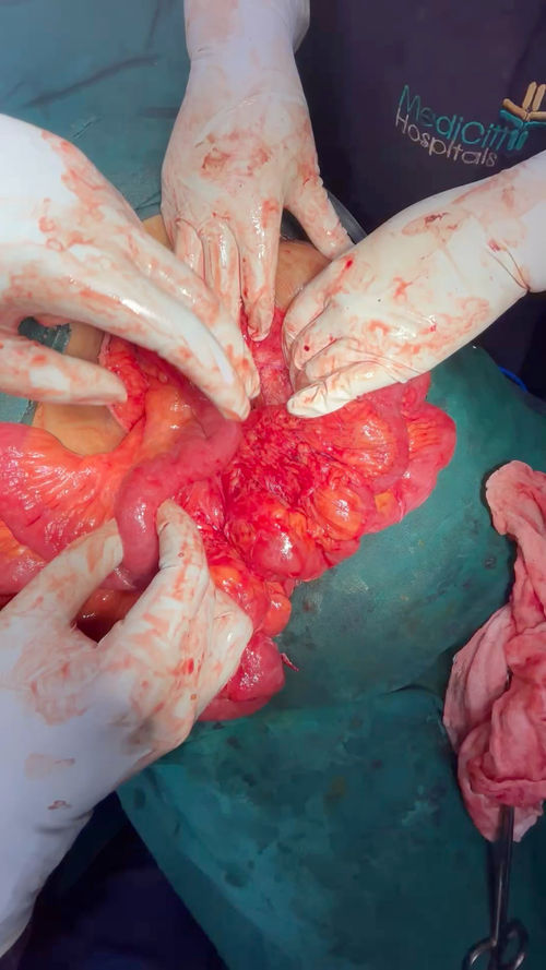 Surgeries & Treatments