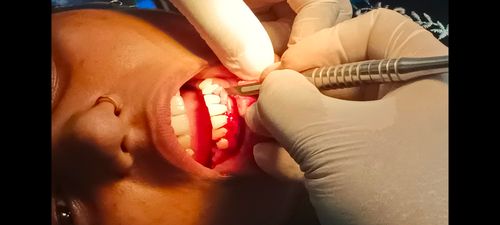Surgeries & Treatments