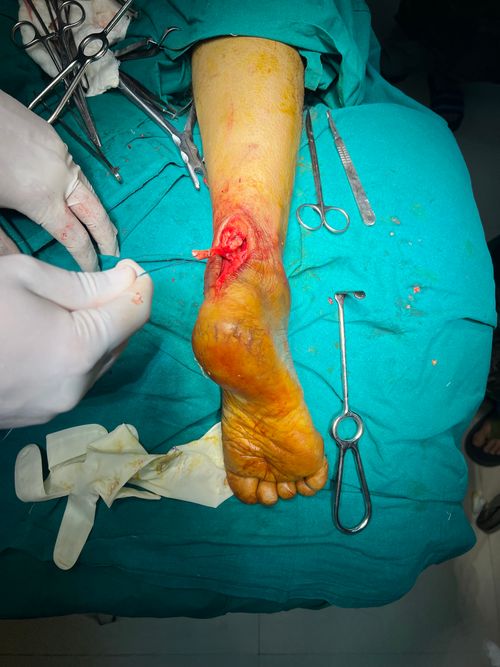 Surgeries & Treatments