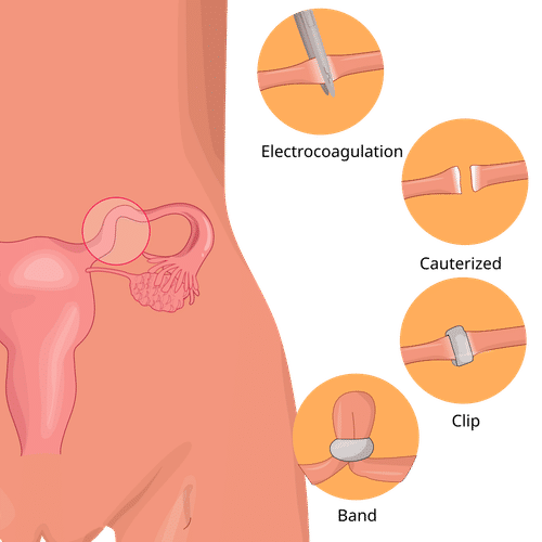 Surgeries & Treatments
