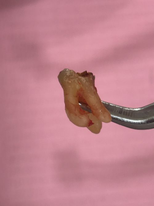 Surgeries & Treatments