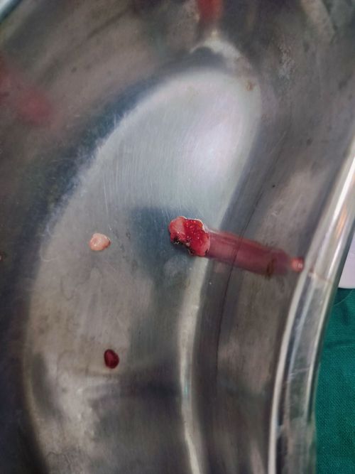 Surgeries & Treatments