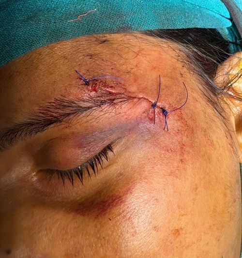 Surgeries & Treatments