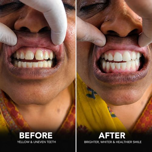 Surgeries & Treatments