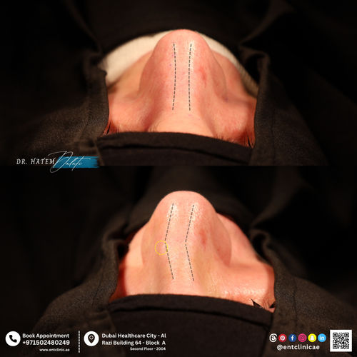 Surgeries & Treatments