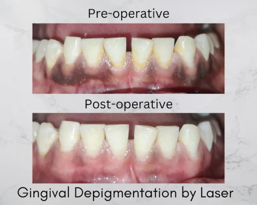Surgeries & Treatments