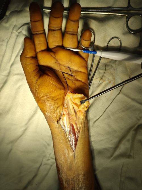 Surgeries & Treatments