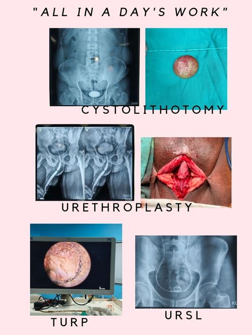 Surgeries & Treatments
