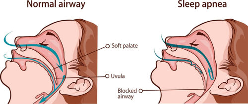Surgeries & Treatments