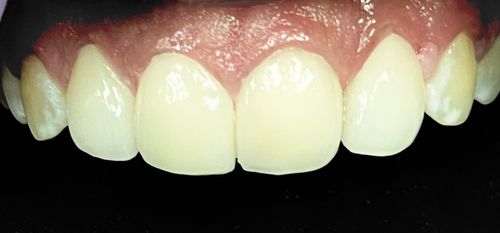 Surgeries & Treatments