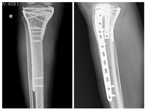 Surgeries & Treatments