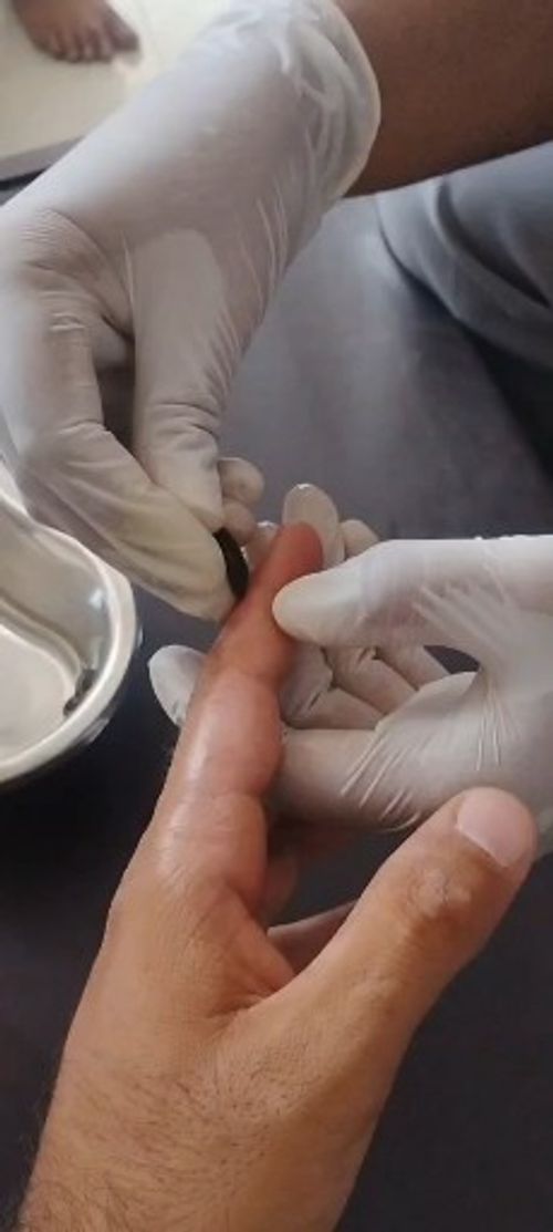 Surgeries & Treatments
