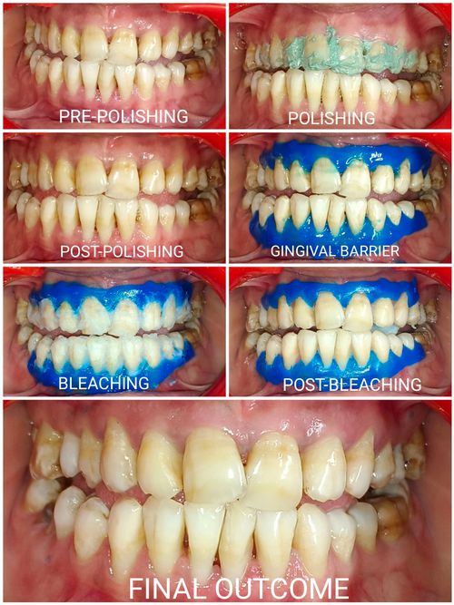 Surgeries & Treatments
